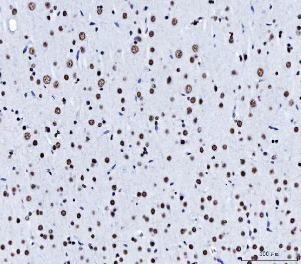 IHC - Anti-CPSF6 Antibody Picoband™ (monoclonal, 3F11E1) ABO16592
